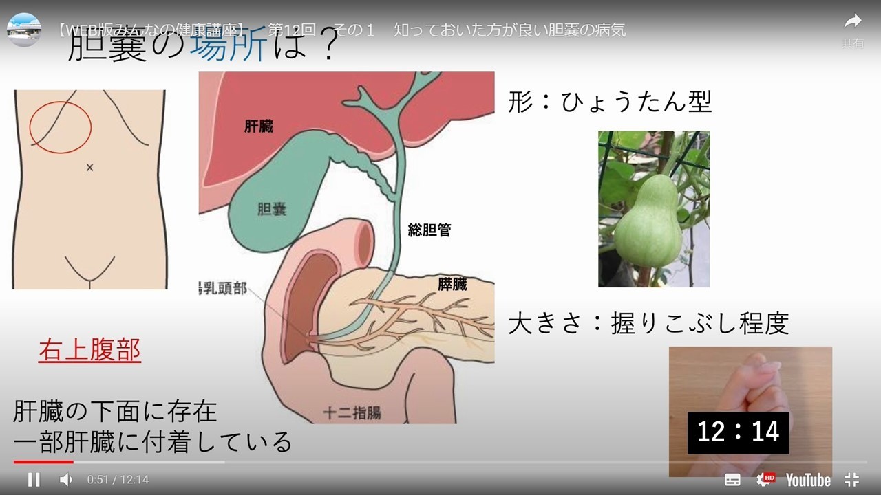 知っておいた方が良い胆嚢の病気